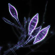 Фото из Википедии. Эта красота и есть возбудитель - грибок Microsporum canis. Мицелий прорастает в кожу, в луковицы волос и там питается, а плодовое тело - прорастает в волос и на кончике выращивает вот эти веретенообразные макроконидии, полные спорами.