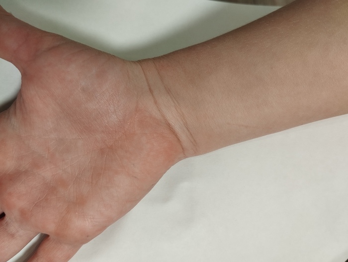 Здоровая рука