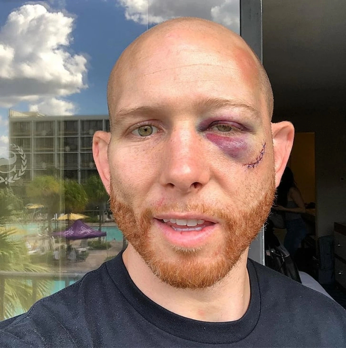 Разбор главного боя предстоящего турнира UFC