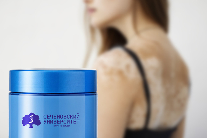 Крем от витилиго создали в Сеченовском Университете