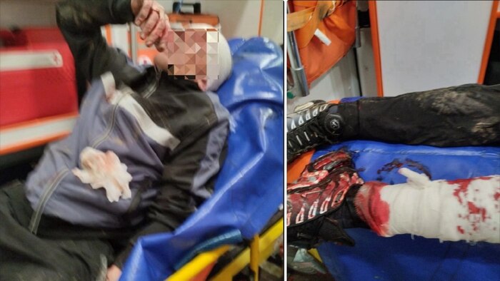 Ранее судимая натравила собак на мужчину