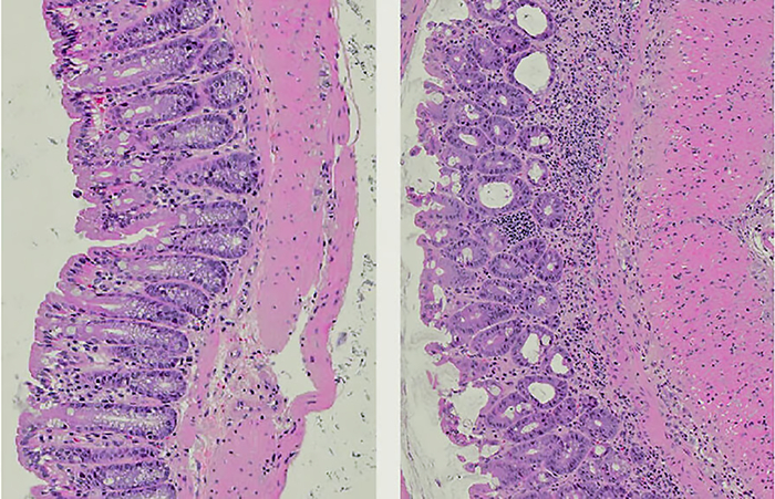 Фастфуд и избыток жирной пищи за несколько дней снижают защиту кишечника
