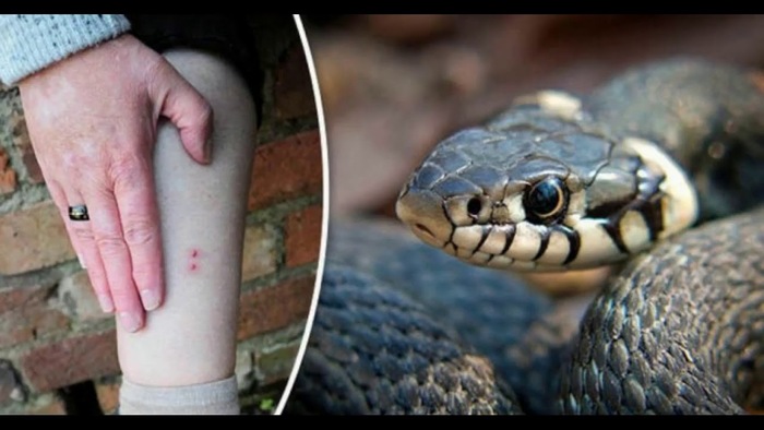 Первая помощь при укусе змеи:что НЕЛЬЗЯ и что НУЖНО делать