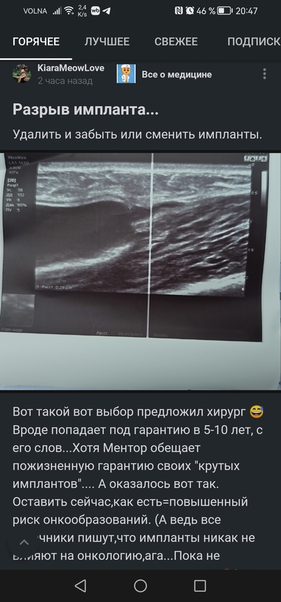 Иллюстрация к комментарию