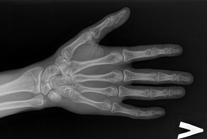 ������ ������ �� �����.