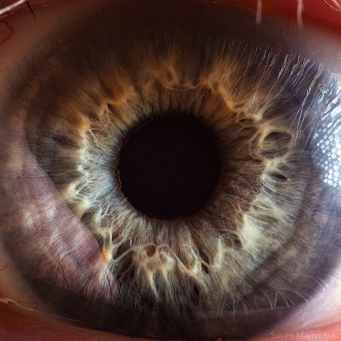 Ххх Зрение, Картина, Длиннопост