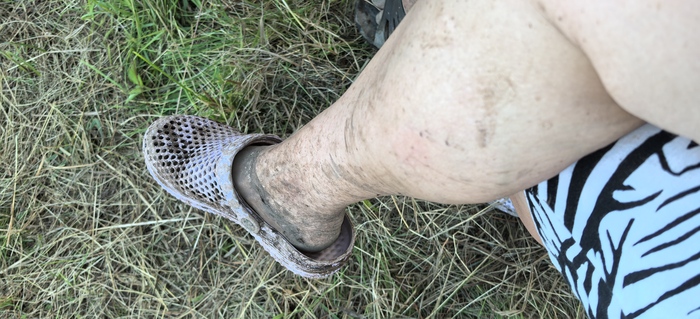 Лечебная новгородская грязь убрала все натоптыши и огрубевшую кожу со ступней😂