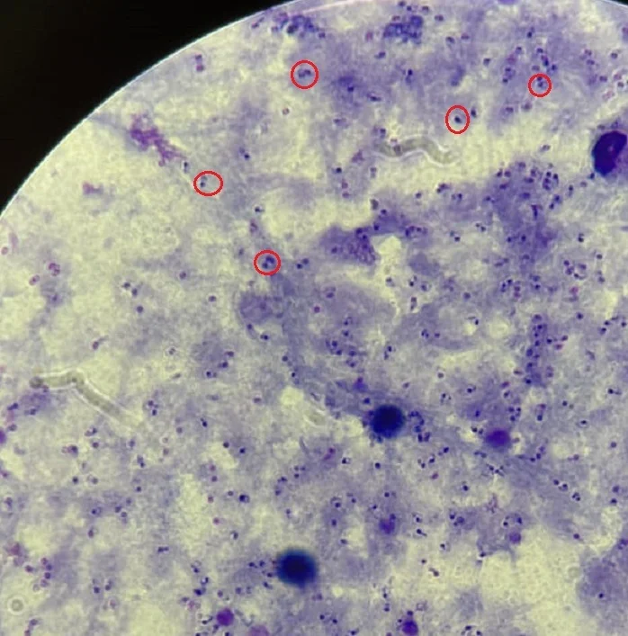 Malaria: Advice for Travellers to Endemic Areas - Series Protozoa, My, The medicine, Treatment, Malaria, Anopheles, Medications