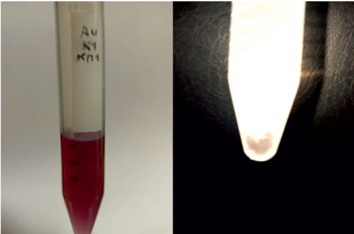 Слева - пробирка с коллоидным золотом (25-50 нанометров). Справа - та же пробирка после 5-и кратной заморозки/оттайки. Образовался самородок размером 1.5 мм.