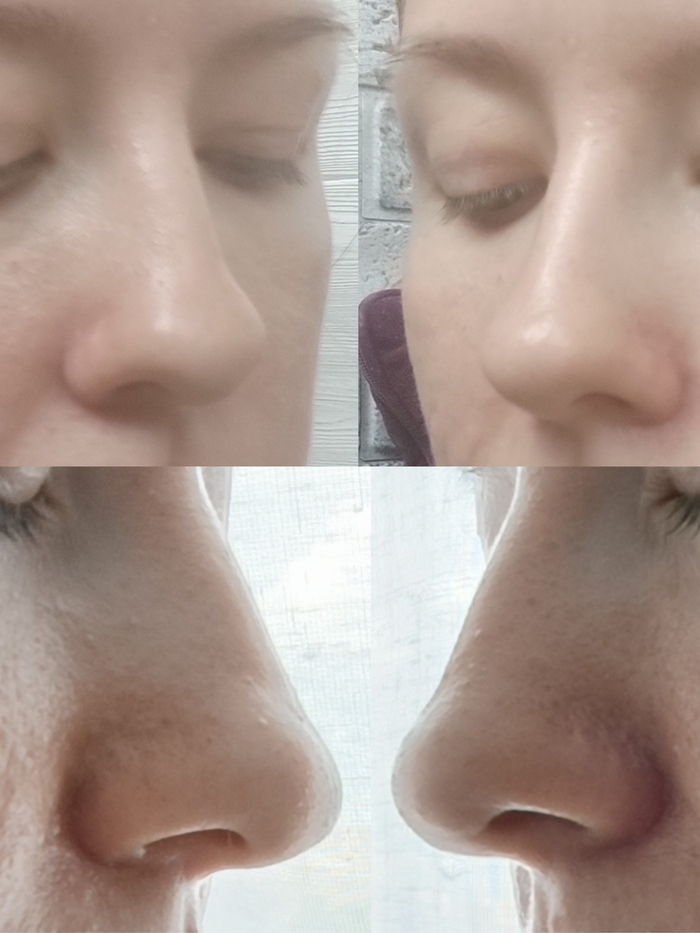 ДО(верхнее фото) / ПОСЛЕ(нижнее фото)