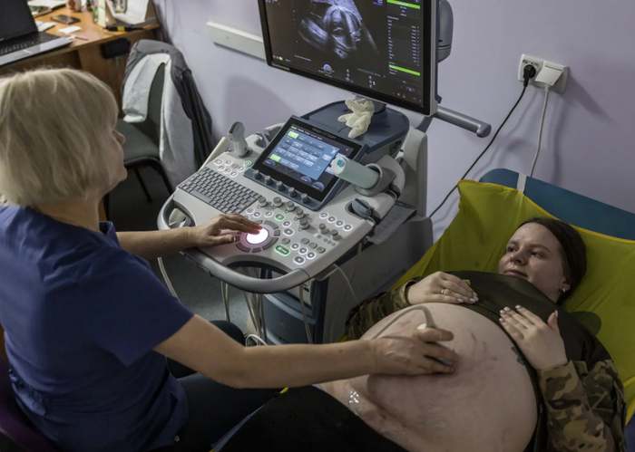 Надя, военный радист, проходит УЗИ в Полтавской больнице в центральной части Украины в январе. Она служила до тех пор, пока не оказалась на восьмом с половиной месяце беременности