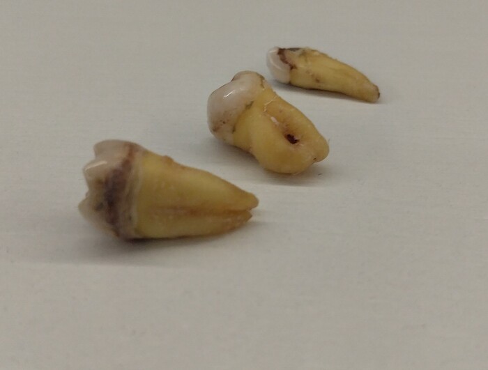 Немного о зубах