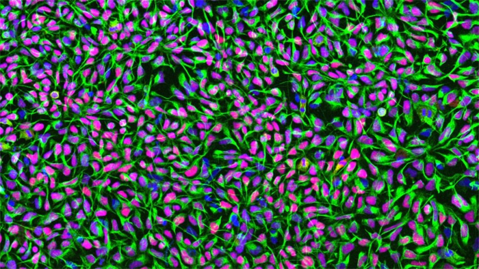 Культуры человеческих нейральных стволовых клеток. Ядра клеток окрашены в синий цвет, специфический для нейральных стволовых клеток филаментный белок Nestin — в зеленый, транскрипционный фактор нейральных стволовых клеток Sox1 — в красный