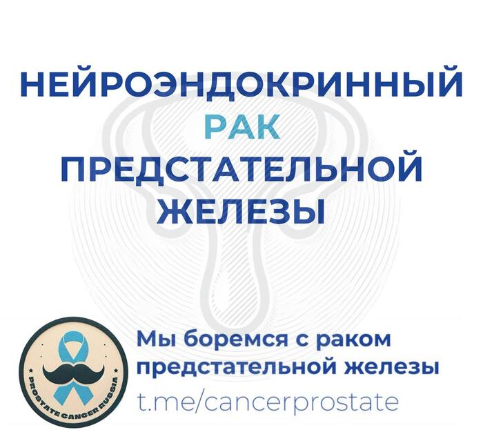 Нейроэндокринный рак предстательной железы