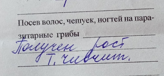 Как узнать точное название этого грибка?