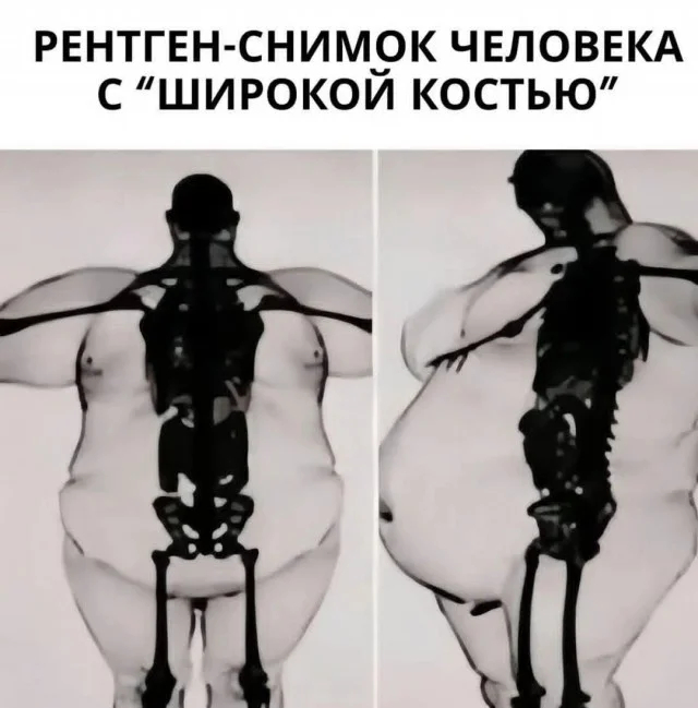 Зачем скелет съел?