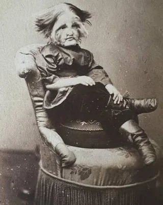 Фёдор Адрианович Евтихиев, известный больше как "Мальчик с пёсьей мордой"