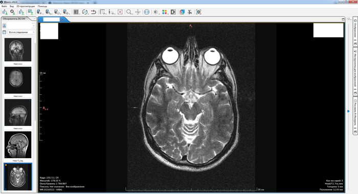 Когда узнал, сколько стоит получить результат на USB-флешке