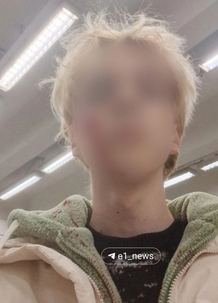 :<!--noindex--><a href="https://pikabu.ru/story/v_ekaterinburge_studenta_izbil_neadekvat_reaktsiya_politsii_dazhe_ne_udivila_13415118?u=https%3A%2F%2Fwww.e1.ru%2Ftext%2Fincidents%2F2025%2F11%2F18%2F76126427%2Fcomments%2F&t=https%3A%2F%2Fwww.e1.ru%2Ftext%2Fincidents%2F2025%2F11%2F18%2F76126427%2Fcomment...&h=989f95a1c6673490e942da5003e2b2b0d819c942" title="https://www.e1.ru/text/incidents/2025/11/18/76126427/comments/" target="_blank" rel="nofollow noopener">https://www.e1.ru/text/incidents/2025/11/18/76126427/comment...</a><!--/noindex-->, <!--noindex--><a href="https://pikabu.ru/story/v_ekaterinburge_studenta_izbil_neadekvat_reaktsiya_politsii_dazhe_ne_udivila_13415118?u=https%3A%2F%2Flenta.ru%2Fnews%2F2025%2F11%2F18%2Frossiyskogo-studenta-izbili-bitoy-vozle-avtovokzala%2F%3Fysclid%3Dmi6ex59x81330612567&t=https%3A%2F%2Flenta.ru%2Fnews%2F2025%2F11%2F18%2Frossiyskogo-studenta-izbili...&h=f9006b8be183f8b4ca011072148e51c2428fe073" title="https://lenta.ru/news/2025/11/18/rossiyskogo-studenta-izbili-bitoy-vozle-avtovokzala/?ysclid=mi6ex59..." target="_blank" rel="nofollow noopener">https://lenta.ru/news/2025/11/18/rossiyskogo-studenta-izbili...</a><!--/noindex-->