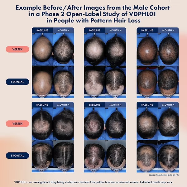 Не поспоришь, результат, как говорится, на лицо на голове