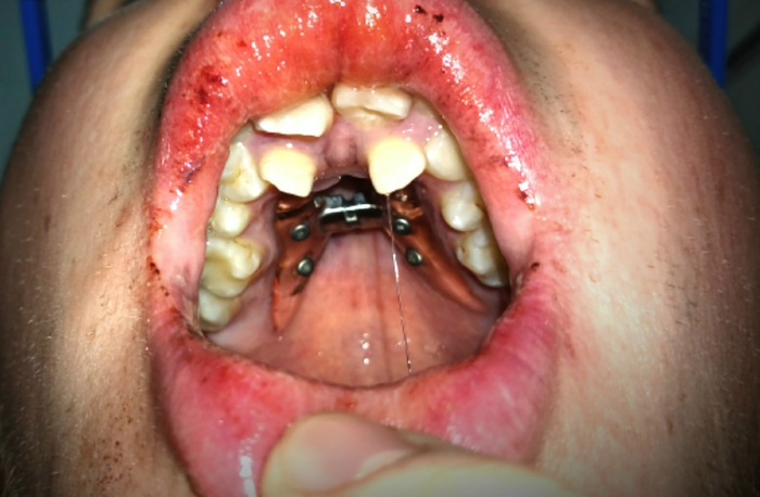 Вот это бабочка конечно во рту...