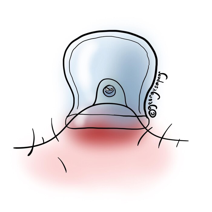 ����� � �����