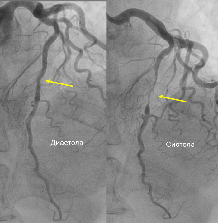 ��������� ������� �������� ����� �������� ��������������� ������� (�������� ����� ��� ����), � ������� ������� �������� �� 90%