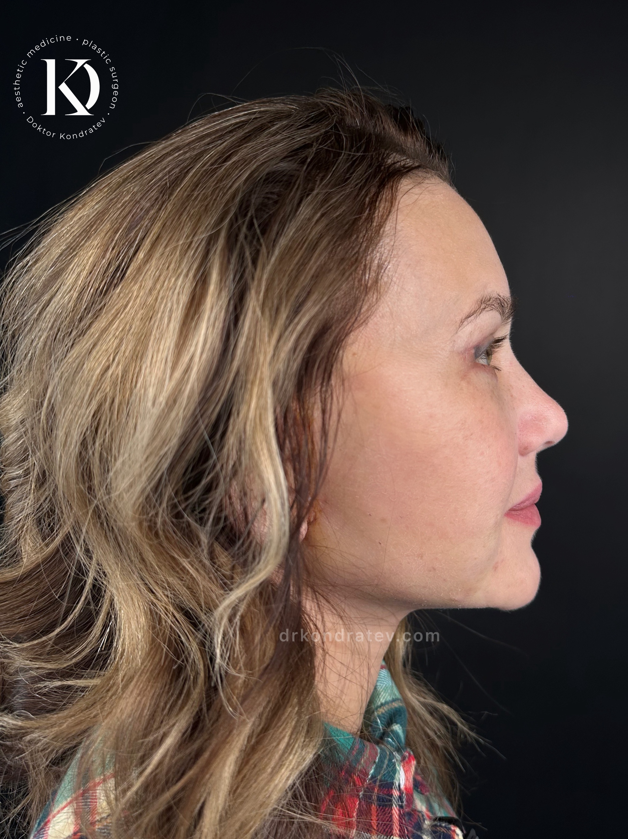 How to restore your original face without signs of overtightening? - My, Face, Facelift, Blepharoplasty, Video, Vertical video, Short videos, Longpost
