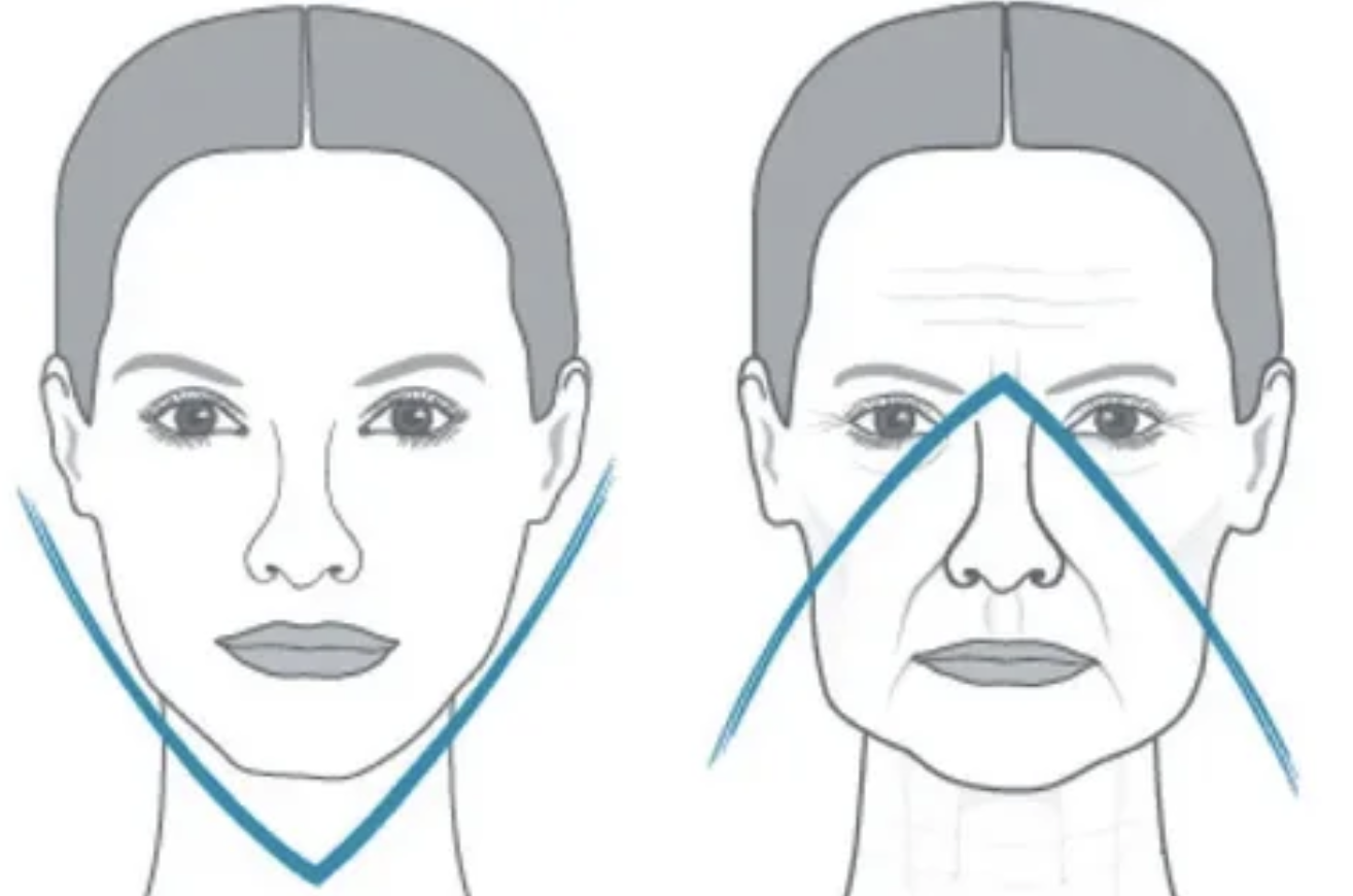 How to restore your original face without signs of overtightening? - My, Face, Facelift, Blepharoplasty, Video, Vertical video, Short videos, Longpost