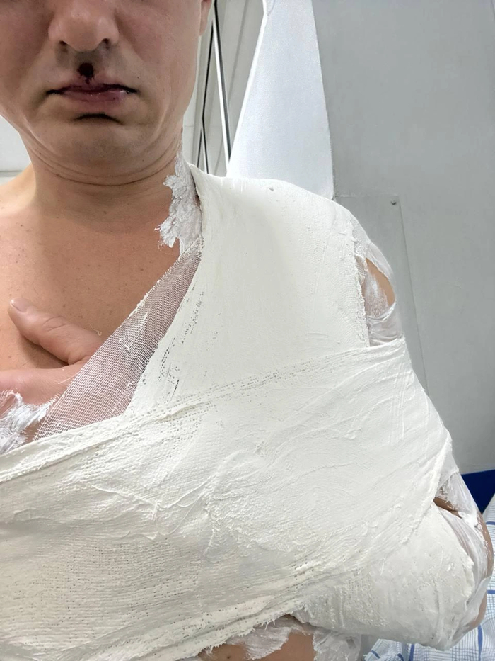 ������� ������� ������ ��-�� ��������� �� ������� ��������