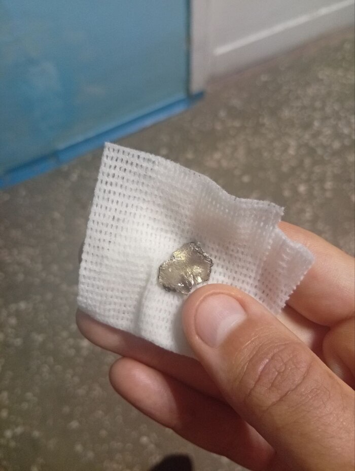 Ранение БПЛАшников. Химарь