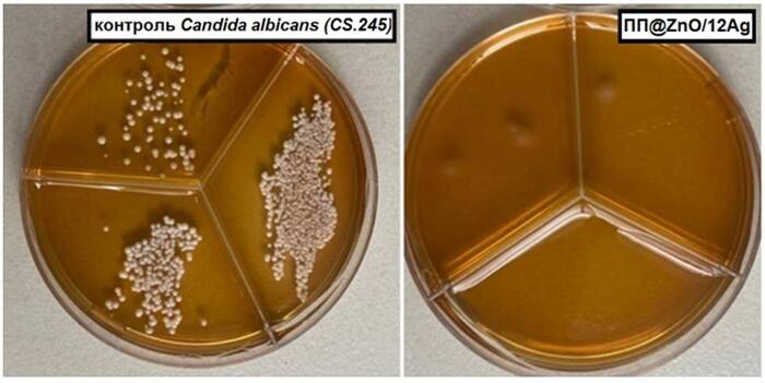 ������, ������� �� ���� ������ �� ����������� ���������� ������� ������. ����: �����-������ ���