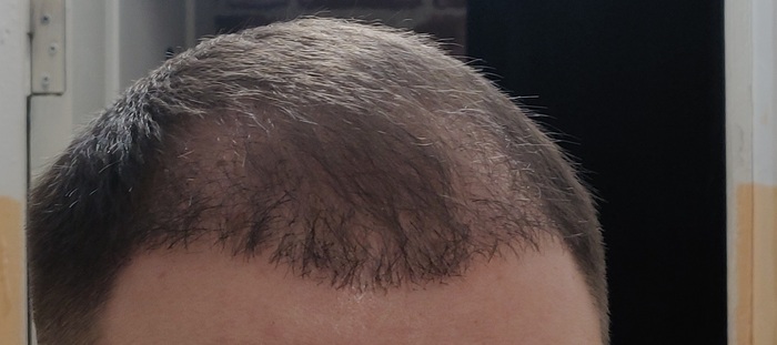 ����� ������� ������� ������