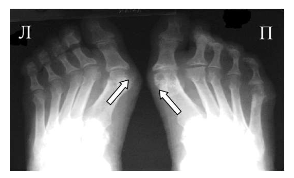 ������� "����������" �� ��������������