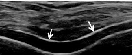 "������� ������" ��� �������