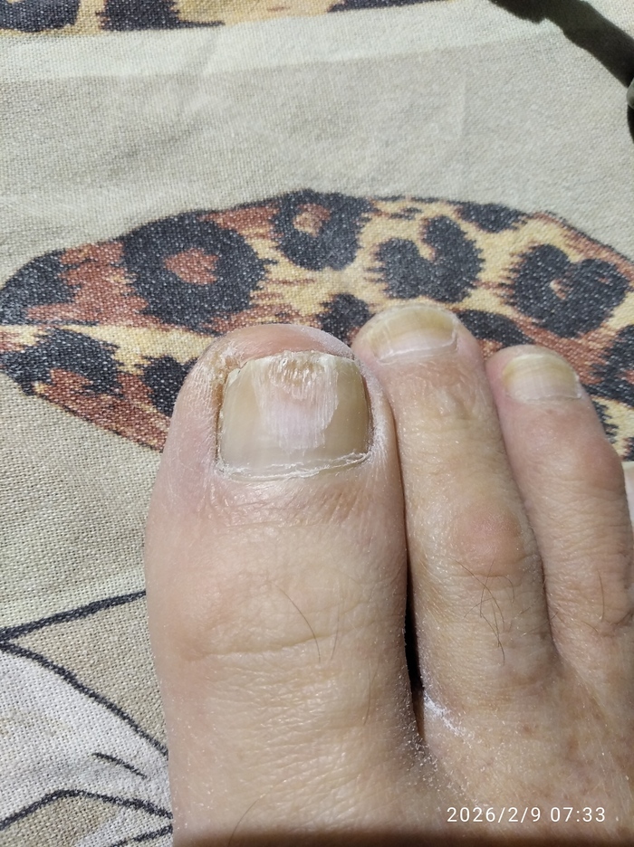 �������� ������� �����