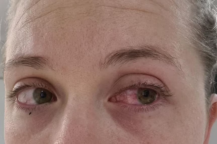 ������ �� ����� �������� ������� ��-�� ��������� ������. &nbsp; ( �������������: ������ ��������� )