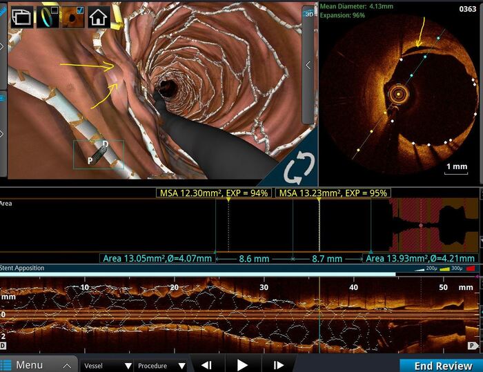 ������� - ������� ������ ������� ����� ������ ������.