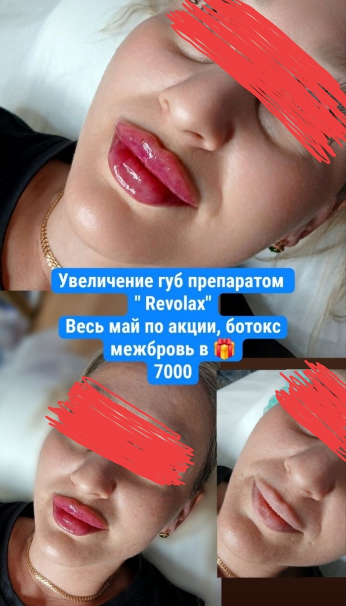 Девушки, вам реально нравятся такие губы?