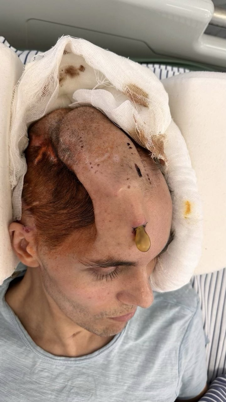 I won't give up and I won't let you or the story of the fight for my husband's life. The Wives Project - Series Project Wives, My, Longpost, Wife, Russian spirit, Regina, Disease history, Injury, Treatment, Surgery, Operation, Video, Vertical video, Short videos, Rutube