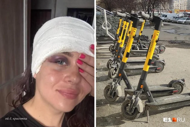 Sober this time. A beautiful blogger from Yekaterinburg crashed her scooter, with blood gushing from her head. - Series Articles from the web, Negative, Incident, Injury, Electric scooter, Scooters, Kick scooter, Yekaterinburg, Longpost