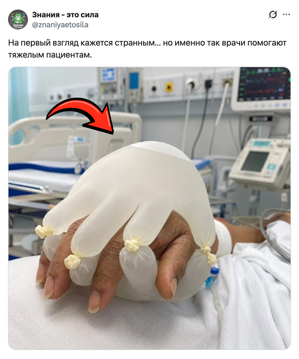 Why do seriously ill patients wear a glove with saline solution on their hands? - Informative, Facts, The medicine, Life hack, Want to know everything, Telegram (link)