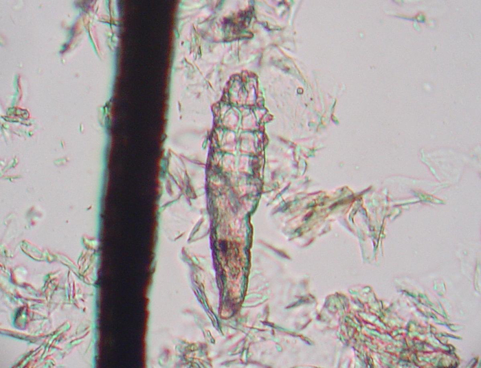 <a href="https://ru.wikipedia.org/wiki/Demodex#/media/%D0%A4%D0%B0%D0%B9%D0%BB:Demodex_mite_1.JPG" target="_blank" rel="nofollow noopener">����: Joel Mills</a>
