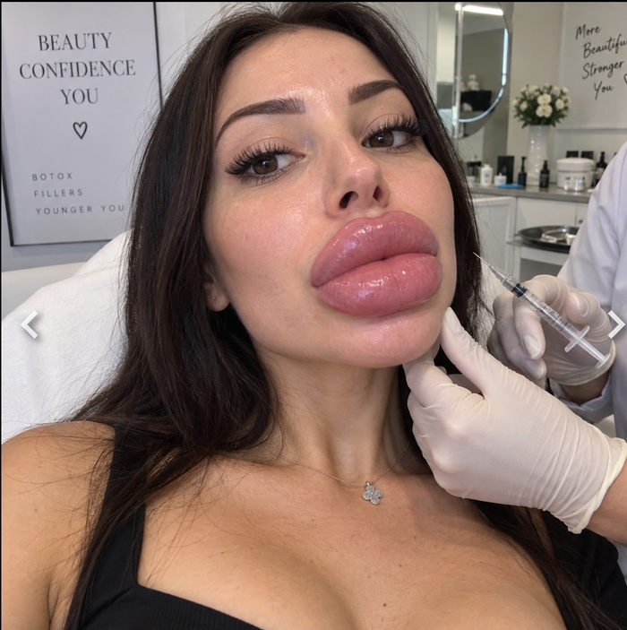 ������� - ������